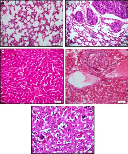 Figure 11 Hematoxylin and eosin staining of (A) normal lung tissue, (B) clumps of metastatic tumor cells, (C) normal liver tissue, (D) clumps of metastatic cells, and (E) the megakaryocyte within the liver sinusoids.