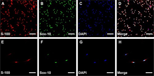 Figure 1 Characterization of SCs.Notes: Double-immunofluorescent staining showed the expression of S-100 (A and E) and Sox-10 (B and F) with DAPI nuclear counterstaining (C and G). Merge image showed a purity of more than 96% SCs (D and H). Scale bars: (A–D) 100 µm (magnification 20×), (E–H) 50 µm (magnification 40×).Abbreviations: SCs, Schwann cells; DAPI, 4′,6-diamidino-2-phenylindole.
