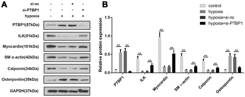 Figure 5 PTBP1 silencing modulates the expression of phenotypic transition-related genes. (A) Western blot was used to detect the expression of phenotypic transition-related genes in PASMCs including PTBP1, ILK, Myocardin, SM a-actin, Calponin, and osteopontin. (B) Statistical results of protein expression was calculated. n=6, **p<0.01.