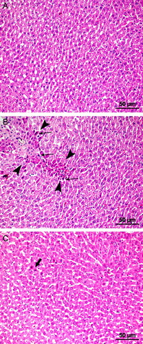 Figure 2 Microscopic images of the liver showing the histopathological samples of laparotomy (A), IR (B), and IR + PG (C) groups (H&E, 200×). (A) Normal hepatocyte formation. (B) Degenerative changes (area marked with arrowheads); necrosis and picnotic nucleus (arrows). (C) Hepatocytes in pomegranate applied group with few picnotic changes (arrows).
