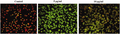Figure 6. Anticancer activity of biosynthesized Siberian ginseng gold nanoparticle. Apoptotic effect of SG-GNPs in murine melanoma cell line B16 was assessed using dual staining technique. B16 murine melanoma cells were treated with 5 and 10 µg/ml SG-GNPs and incubated for 24 h. The control and treated cells were then stained with 1 mM acridine orange and 1 mM Ethidium bromide for 5 min. The experiments were performed in triplicates.