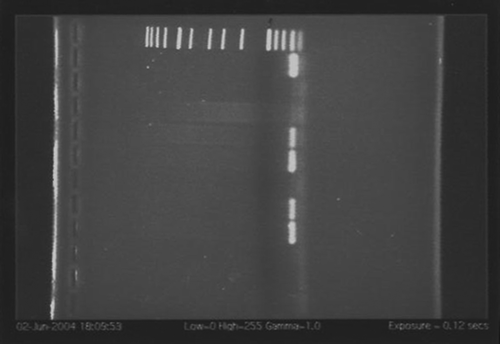 Figure 1.  Lactobacillus iners-specific PCR assay of vaginal specimens. Lanes 1–9, PCR products of vaginal specimen DNA amplified from subjects 1–9; lane 10, negative control; lane 11, positive control using L. iners DNA; lane M, GeneRuler™ DNA ladder.