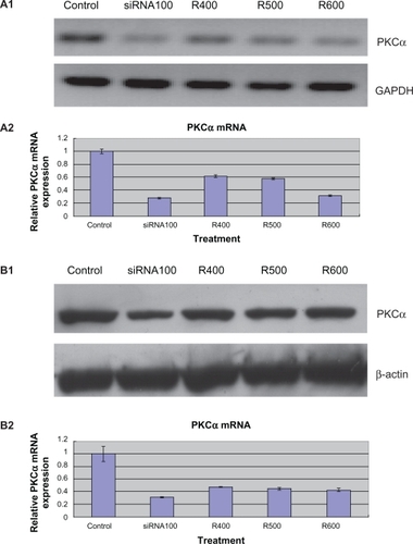 Figure 4 Expression of protein kinase Cα (PKCα) messenger RNA (mRNA) and protein downregulation by released small interfering RNA (siRNA)-PKCα in retinal pigment epithelium (RPE) cells. A1, A2) RT-PCR showed that released siRNA-PKCα reduced the mRNA levels of PKCα significantly compared with control groups. *P < 0.05 vs the corresponding value for control groups. Data are the mean ± standard deviation of quadruplicates from an experiment that was repeated with similar results (siRNA100 means RPE cells treated with 100 nM siRNA-PKCα; R400, R500, and R600 mean RPE cells treated with siRNA-PKCα released from foldable capsular vitreous bodies containing 400, 500, and 600 nM siRNA-PKCα). B1, B2) Western blot showed that released siRNA-PKCα reduced the protein levels of PKCα significantly compared with control groups.