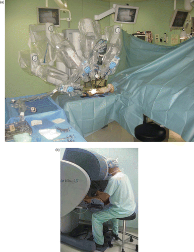 Figure 2. Installation of the da Vinci S® robot. (a) The patient cart is fitted with a sterile cover and is located opposite the conventional surgeon's position. The robot arms are obliquely directed in such a way that the instruments are placed in the same direction as those of a conventional operator. No operative assistance is necessary. (b) The surgeon's console is placed several meters distant from the patient, on the anesthetist's side. The surgeon handles the instruments remotely, without sterile clothing. His head is placed inside the safety system which allows the release of the instruments.