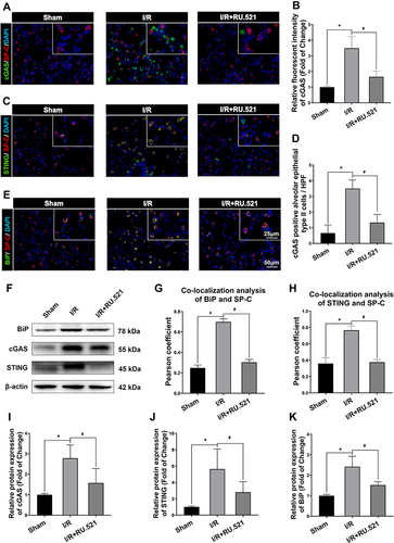 Figure 2 Western blot and colocalization of cGAS, STING and BiP with alveolar epithelial type II cells marker of rats. (A) Double immunofluorescent staining to colocalize cGAS with alveolar epithelial type II cells marker SP-C in lung tissue. (B) Immunofluorescent density analysis to quantify the expression of cGAS. (C) Double immunofluorescent staining to check localization of STING expression in alveolar epithelial type II cells. (D) Number of cGAS positive alveolar epithelial type II cells in high power field (HPF). (E) Colocalization of BiP with alveolar epithelial type II cells marker by using double immunofluorescent staining. (G) The quantified colocalization of BiP with alveolar epithelial type II cells marker were assessed using the Pearson coefficient. (H) The quantified colocalization of STING with alveolar epithelial type II cells marker were assessed using the Pearson coefficient. Scale bar = 25μm or 50μm. Data are presented as mean ± SEM, n = 6 per group. (F and I-K) Western blotting analysis to verify the expression of cGAS, STING and BiP, β-actin was used as the loading control. Data are presented as mean ± SEM, n = 3 per group. *P < 0.05 vs sham group, #P < 0.05 vs I/R group.