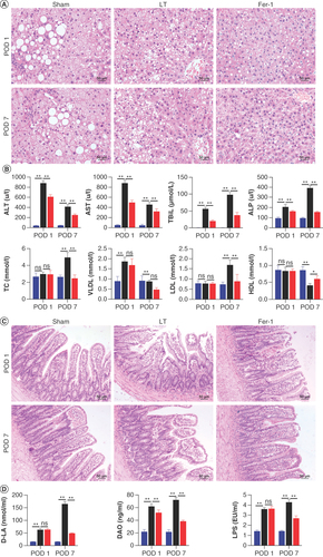 Figure 2. Histological and functional changes in transplanted liver and recipient intestines. (A) Histopathology of severe steatotic transplanted liver (hematoxylin and eosin [H&E] staining, ×200). (B) Liver function. (C) Recipient intestinal histopathology (H&E staining, ×200). (D) Intestinal permeability of recipients.ALP: Alkaline phosphatase; ALT: Alanine aminotransferase; AST: Aspartate aminotransferase; DAO: Diamine oxidase; D-LA: D-lactic acid; HDL: High-density lipoprotein; LDL: Low-density lipoprotein; LPS: Lipopolysaccharide; POD 1: Postoperative day 1; POD 7: Postoperative day 7; TBil: Total bilirubin; TC: Total cholesterol; VLDL: Very low-density lipoprotein.