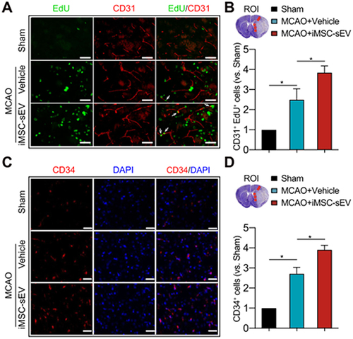 Figure 7 iMSC-sEV promote angiogenesis following stroke and increase HUVEC migration and tube formation after OGD. (A–D) Seven days after MCAO, angiogenesis was evaluated by immunofluorescence staining of CD31/EdU and CD34. Scale bar = 100 μm. *P < 0.05. Reproduced from Xia Y, Ling X, Hu G, et al. Small extracellular vesicles secreted by human iPSC-derived MSC enhance angiogenesis through inhibiting STAT3-dependent autophagy in ischemic stroke. Stem Cell Res Ther. 2020;11(1):313. Creative Commons.Citation43