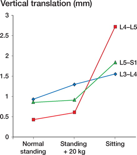 Figure 1:5B Mean mobility along the vertical axis over the lower 3 lumbar segments in 12 patients, investigated in 3 standardized positions of provocation.