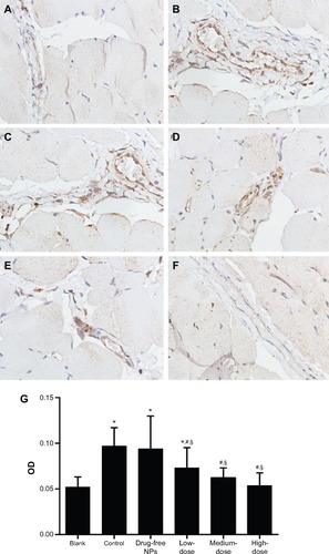 Figure 9 Collagen I expression in the peritoneal tissues after 7 days of treatment, detected by immunohistochemistry.Notes: High, medium and low dose groups were administered with 10 mg/kg, 5 mg/kg and 2.5 mg/kg Tan IIA-NPs via tail vein injection, respectively. Representative images (at 200× magnification) of peritoneal tissues that were stained immunohistochemically with anti-collagen I antibody. (A) Blank control group. (B) Control group. (C) Drug-free group. (D) Low-dose group. (E) Medium-dose group. (F) High-dose group. (G) Quantitative assay of OD from five randomly selected fields. The results are presented as mean ± standard deviation (n=5). *P<0.05 compared with blank; #P<0.05 compared with control; §P<0.05 compared with drug-free NPs.Abbreviations: NPs, nanoparticles; OD, optic density.