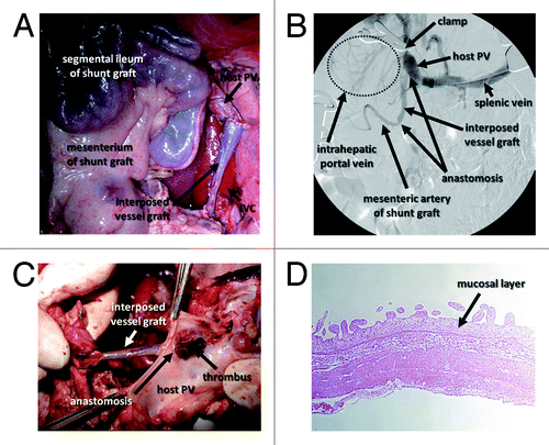 Figure 4. Intraoperative and postoperative findings of intestinal PCS in pigs. (A) Intraoperative image of the ileal graft and interposed vessel graft anastomosed to the host PV. (B) Intraoperative portography shows that temporary PH created by clamping the PV led to the visualization of the mesenteric artery of the intestinal graft. (C) The graft vessel interposed between the portal vein and small intestinal segment is occupied with a thrombus. (D) HE staining shows shortened villi and a thinned mucosal layer of the small intestinal segment.