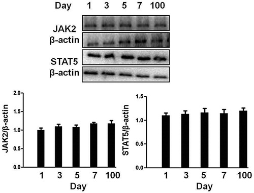 Figure 2. Analysis of signaling protein expression in the hepatocytes obtained from 1 to 7 days old and 100 days old pig. The cell extracts from porcine hepatocytes were subjected to immunoblotting with the indicated antibodies. After incubation with secondary antibody at room temperature, the immunoreactive bands were detected using an ECL-plus kit. The figure is representative of three independent experiments.