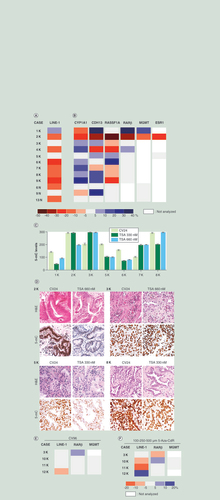 Figure 4. Epigenetic response to chromatin remodeling agents in organotypic cultures. (A & B) Differences of methylation levels observed in LINE1 (A) and gene promoters (B) in neoplastic (1–9K) and non-neoplastic (6, 9 and 13N) tissue slices after 24 h of TSA treatment. All TSA-treated samples were compared with the vehicle (CV24). The boxes represent the differences of methylation expressed as percentages. The color scale is defined in the bottom. Methylation differences exceeding ±5% were considered informative. (C & D) 5-mC levels by immunohistochemistry observed at T0 and after TSA treatment (330 and 660 nM). (C) Global methylation changes before and after TSA treatment. All data were scored by multiplying the percentage of positive cells (0–100%) for the staining intensity (scale of 0-absent staining to 3-strong staining). Maximum value = 300. Bars represent mean ± standard error of the mean. (D) Representative images of four cases, stained with H&E and a 5-mC antibody. Original magnification: ×200. (E & F) Differences of methylation levels expressed as percentages in LINE-1 and in RARβ and MGMT promoters observed after 96 h of culture (CV96) (E) and 96 h of treatment with 5-Aza-CdR (F). The cultured samples were compared with uncultured tissues (T0) (E) and the 5-Aza-CdR treated samples were compared with vehicle (CV96) (F).5-mC: 5-methylcytosine; H&E: Hematoxylin and Eosin; TSA: Trichostatin A.