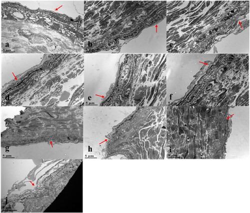 Figure 10. Transmission electron microscopy results of skin morphology with and without MNs for different drug effects ((A) Blank group; (B) Solvent group; (C) MNs (6 h); (D) Geniposide; (E) Ferulic acid; (F) Curcumin; (G) MNs + Geniposide; (H) MNs + Ferulic acid; (I) MNs + Curcumin; (J) MNs (0 h)).