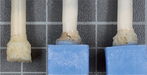 Figure 2. Representative examples of failure at the interface of the bone probes. On the left is an example of tensile failure. In the middle and on the right are examples of failure under torsion.