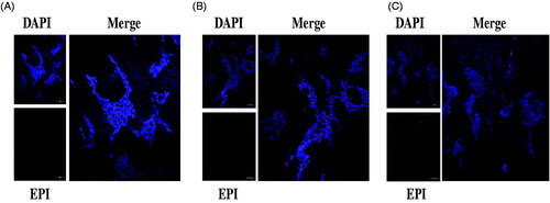 Figure 14. Fluorescent distribution in slice of HepG2 tumours with NPs-EPI (A), NPs-EPI/HAase (B) and NPs-EPI/HAase/G-iRGD (C). The upper left image of Figure (A–C) represents DAPI stained nuclei and the lower left image of Figure (A–C) represents EPI.