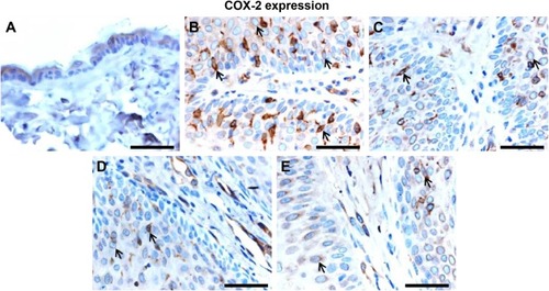 Figure 6 Effect of Leiurus quinquestriatus venom extract on COX-2 expression in chemically induced skin tumors.