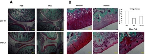 Figure 6 Representative Safranin O/Fast green staining of rat knee joints (A, control: PBS, injured: MIA) and femoral articular cartilages (B) in both joints with (Ful) or without (NT) fullerol treatment.Notes: Osteoarthritis was induced in the knee joints by intra-articular injection of MIA for up to 21 days. It was shown that MIA-induced histopathological alterations, including a decrease in the matrix production and the thickness of the articular cartilage, erosion of the articular cartilage, disorientation of the chondrocytes, fibrillation of the superficial zone and exposure of the subchondral bone, were time-dependent (A). Fullerol alleviates the loss of matrix, chondrocytes (black arrows) and cartilage thickness (black lines and the bar chart) in the femoral articular cartilage (B). Abbreviations: MIA, monoiodoacetate; NT, no treatment.