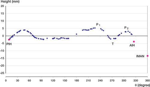 Figure 2. An acetabular rim shown as a two-dimensional profile using cylindrical coordinates.The anatomical landmarks identified on the acetabular rim are the posterior inferior horn (PIH), anterior inferior horn (AIH), and inferior margin of the acetabular notch (IMAN).The depth of the psoas valley is the difference between the average heights of adjacent peaks (P1 and P2) and the height of the central trough (T).