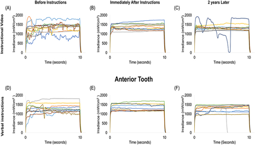 Figure 2 Representative measurements of the irradiance values (mW/cm2) delivered to the MARC-PS anterior tooth using the instructional video teaching method: (A) before receiving any instructions, (B) immediately after receiving instructions, and (C) after two years of clinical experience treating patients. Also showing representative measurements of the irradiance values delivered to the MARC-PS anterior tooth using the verbal instructions teaching method: (D) before receiving any instructions, (E) immediately after receiving instructions, and (F) after two years of clinical experience treating patients.
