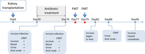 Figure 1 Treatment timeline for CRKP infection.
