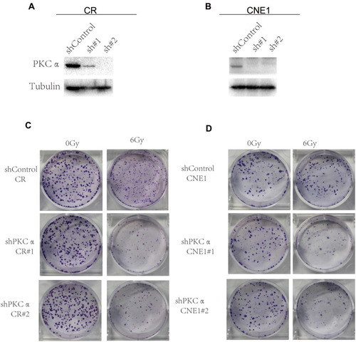 Figure 4 Inhibition of PKCα sensitizes NPC cells to radiation in vitro. (A) Western blotting of PKCα expression in CR cells after treatment with shControl, shPKCα #1, or shPKCα #2. (B) Western blotting of PKCα expression in CNE1 cells after treatment with shControl, shPKCα #1, or shPKCα #2. (C) Clonogenic assay for CR cells treated with shControl or shPKCα and later exposed to 0 or 6 Gy radiation (n=3; P<0.05). (D) Clonogenic assay for CNE1 cells treated with shControl or shPKCα and later exposed to 0 or 6 Gy radiation (n=3; P<0.05).