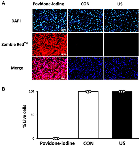 Figure 2 Cell viability 3 h after ultrasound irradiation. (A) Bone marrow-derived macrophages were stained with Zombie Red™ immunofluorescence reagent. After fixation, the cells were counter-stained with DAPI. (B) The percentage of live cells to total cells was calculated. Triplicate cell cultures were analyzed and 10 random fields of each dish were examined. Mean and individual data points are shown.