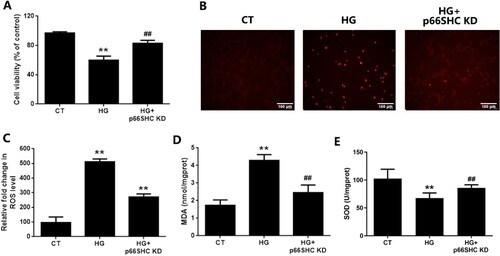 Figure 7. The in vitro p66SHC knockdown ameliorates oxidative damage of EGCs under hyperglycemic stress. CRL-2690 cells with p66SHC knockdown were treated with high glucose (200 mM) for 24 h. A: Cell viability was assessed using MTT assay. B: Cell apoptosis was evaluated using TUNEL assay. C: ROS generation was investigated using DCFH-DA staining. D: MDA level of cell lysates was assessed using TBA assay. E: SOD activity of cell lysates was studied using NBT assay. ** p < 0.01 vs. CT, ## p < 0.01 vs. HG. CT: control; HG: high glucose; KD: knockdown.
