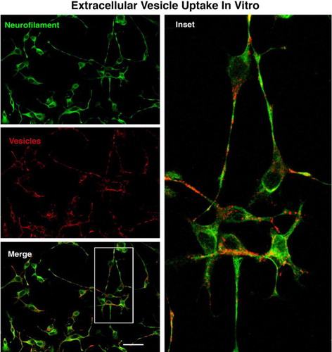 Fig. 3 The motor neuron cell line NSC-34 was exposed to fluorescently labelled vesicles for 3 hours, then fixed and stained for neurofilament to label neurite processes. There was extensive uptake of the labelled vesicles by the neurite processes with some indication of accumulation around perinuclear regions. Size bar=50 microns.