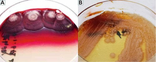 Figure 4 (A and B) Microbiological examination-colony morphology: T. marneffei is thermally dimorphic, growing as a mycelium at 25°C (A) and as yeast-like cells at 37°C (B) on Sabouraud dextrose agar for two weeks.