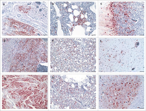 Figure 4. Detection of avian influenza virus nucleoprotein in infected chickens using immunohistochemistry Detection of influenza- nucleoprotein by immunohistochemistry (ABC method, intranuclear and intracytoplasmis bright red antigen signal by 3-amino-9-ethyl-carbazol chromogen and haematoxylin (blue) counterstain): heart (a, d, g), lung (b, e, h) and brain (c, f, i) samples obtained from birds infected with Hp-NS224 (a-c), HP- NS230 (d-f) and HP-NSLp (g-i) at 4 d post infection; for detailed data on the full tropism to different organs examined in this study readers are refered to Table S2. Bar = 50 µm.