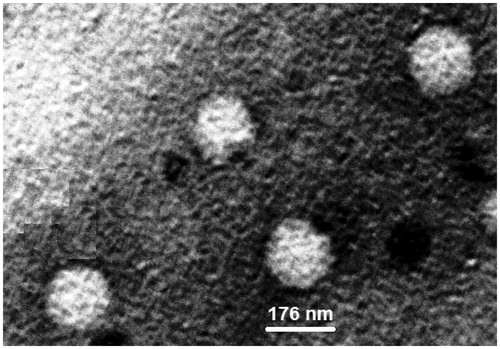 Figure 5. SEM image of solid lipid nanoparticle.