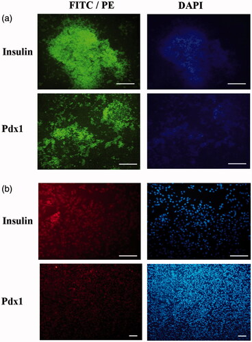 Figure 5. Immunocytochemical analysis in end stage derived IPCs. Immunofluorescence analysis detected nuclei localization of PDX1 and cytoplasmic localization of insulin in differentiated IPCs at day 14 in the 3D group (a) and 2 D group (b). Counter-staining of nucleus was performed by DAPI. Images were obtained by a fluorescence microscope. Scale bars are 100 µm.