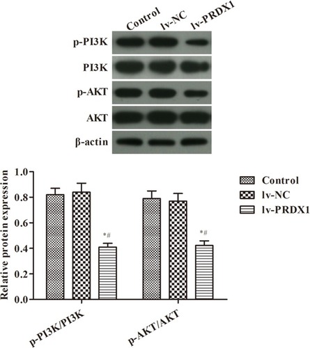 Figure 3 WB assay for the activity of the PI3K/AKT pathway in esophageal squamous cell carcinoma cells. *p<0.05, compared with the control group; #p<0.05, compared with the lv-NC group.