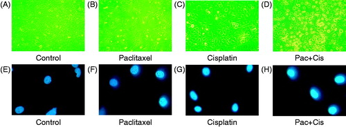 Figure 3. Morphological changes of OS cells with different drugs at 43 °C for 1 h. (A) Morphological appearance of OS cells under inverted phase contrast microscope ×400. (B) Morphological changes of OS cells treated with 10 μg/mL paclitaxel under inverted phase contrast microscope ×400. (C) Morphological changes of OS cells treated with 5 μg/mL cisplatin under inverted phase contrast microscope ×400. (D) Morphological changes of OS cells treated with combination of 10 μg/mL paclitaxel with 5 μg/mL cisplatin under inverted phase contrast microscope ×400. (E) Fluorescent staining of OS cells under the fluorescence microscope ×400. (F) Fluorescent staining of OS cells treated with 10 μg/mL paclitaxel under the fluorescence microscope ×400. (G) Fluorescent staining of OS cells treated with 5 μg/mL cisplatin under the fluorescence microscope ×400. (H) Fluorescent staining of OS cells treated with 10 μg/mL paclitaxel and 5 μg/mL cisplatin under the fluorescence microscope ×400.