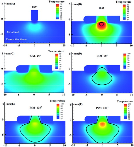 Figure 4. Temperature distribution in the tissue after 60 s of RF ablation across 5 mm wall thickness and 4 mm catheter spacing, considering three modes of ablation: (A) unipolar mode, (B) bipolar mode, and (C∼F) phase shift angle ablation PsM-45°, PsM-90°, PsM-135°, PsM-180°. The solid black line is the thermal damage border.