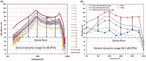 Figure 4. (a) Frequency responses of individual audio processors at 60 dB SPL input, average response at 60 and 90 dB SPL input, and maximum dynamic range of the system determined by MFO minus noise floor (vertical lines at 0.5, 1, 2 and 4 kHz) and (b) illustrates the audibility of average ordinary speech corresponding to a 70 dB overall long term average speech spectrum (LTASS) including peak and valley levels giving a 30 dB speech dynamic range (transformed from SPL to force level) as well as the clinical dynamic range dB for these patients determined by MFO minus thresholds.