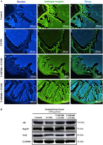 Figure 3. Immunofluorescence staining of the seminal vesicles compared among (Ab–c) control, (Ae–f) CUMS, (Ah–i) T-MP300 + CUMS, and (Ak–l) T-MP600 + CUMS groups against anti-androgen receptor (AR). Hoechst 33342 emitting blue fluorescence used as nuclear counterstain. AR immunostaining (green fluorescence). Expressions of (B) AR, heat shock protein 70 (Hsp70), and nuclear factor erythroid 2-related factor 2 (Nrf2) in seminal tissue compared among groups (n = 8, each group).