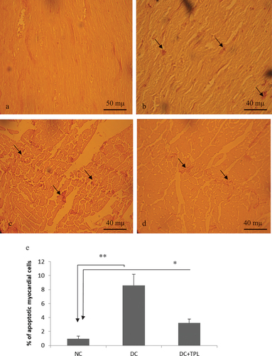 Figure 4. Histology sections of cardiac muscle showing apoptotic myocytes (TUNEL-positive cells DAB-stained in black, ×350). a and b myocardium of control rats. d and c myocardium of diabetic rats, showing significantly dense stains and significantly high counts of TUNEL-positive cells (inset). c. Myocardium of diabetic rats treated with tempol for four weeks, showing less dense stains and lower counts of apoptotic cells compared to diabetic non-treated rat (D). e frequency of apoptotic myocardial cells assess by QuPath bio-image analysis software 3.2, in groups of control rats, diabetic rats and tempol-treated diabetic rats (*p < 0,01 vs NC and **p < 0.001 vs NC).