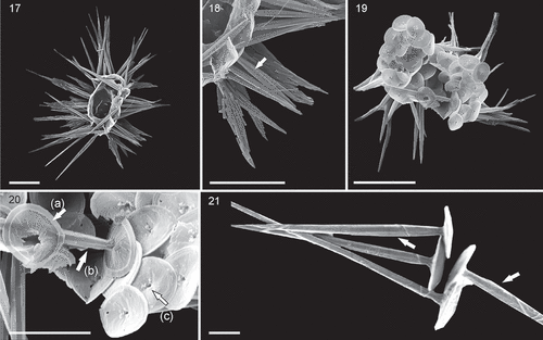 Figs 17–21. SEM micrographs of Palusphaera crosiae sp. nov. Scale bar = 5 μm for Figs 17, 18, 19