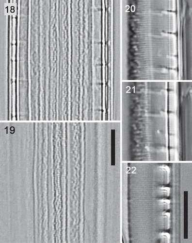 Figs 18–22. Details of type A frustules: high resolution light microscopy (condenser oiled, NA = 1.4). Figs 18, 19. Type A1 (Nitzschia dicrogramma): ventral and dorsal focuses of a frustule, girdle view, showing porous girdle bands. Figs 20, 21. Type A1 (N. dicrogramma): two focuses of a valve in valve view with c. 43 striae in 10 µm, irregular texture towards the dorsal side (to left), and transapically elongate fibulae. Fig. 22. Type A2 valve (N. brachygramma) in valve view with c. 48 striae in 10 µm. Scale bars = 5 µm (for Figs 18, 19, see Fig. 19; for Figs 20–22, see Fig. 22).