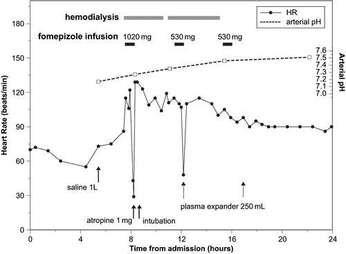 Fig 1. Bradycardia associated with intravenous fomepizole infusion in a patient with ethylene glycol poisoning.