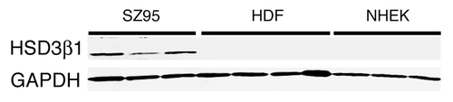 Figure 3. 3β-HSD type I expression in vitro. Confluent cultured SZ95 sebocytes (SZ95), primary dermal fibroblasts (HDF) and primary epidermal keratinocytes (NHEK) were harvested. Total protein fractions were isolated and subjected to western blot analysis using an anti 3β-HSD type I antibody. An anti-GAPDH antibody served as loading control.