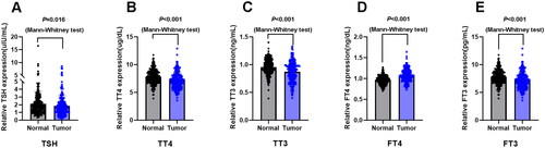 Figure 2. Serum thyroid hormones concentrations in lung cancer patients and their clinical significance. (A) Serum concentration of thyroid stimulating hormone (TSH) in lung cancer patients (n = 205) and healthy subjects (n = 238). (B) Serum concentration of total thyroxine (TT4) in lung cancer patients (n = 205) and healthy subjects (n = 238). (C) Serum concentration of total triiodothyronine (TT3) in lung cancer patients (n = 205) and healthy subjects (n = 238). (D) Serum concentration of free thyroxine (FT4) in lung cancer patients (n = 205) and healthy subjects (n = 238). (E) Serum concentration of free triiodothyronine (FT3) in lung cancer patients (n = 205) and healthy subjects (n = 238). Data are shown as the mean ± SD.