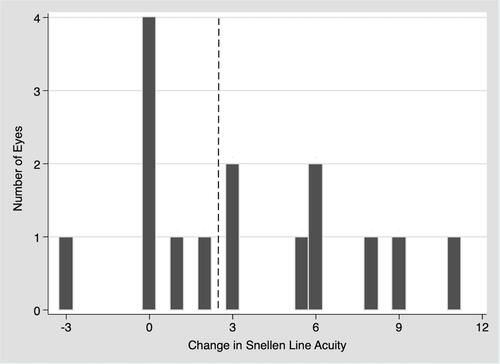 Figure 1 A histogram demonstrating the number of lines of improvement in Snellen acuity by the frequency of occurrence, for patients treated with intra-arterial tPA for CRAO. Of the eight (53%) eyes that improved by more than three (right of the dotted line), six (75%) improved by five lines or more. Only five (33%) eyes showed no improvement or worsening, while two (13%) improved although by less than three lines.