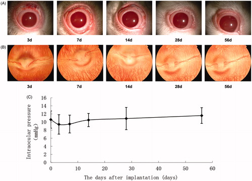 Figure 6. Clinical observations after the drug delivery system implantation in the Tenon's sac of rabbit eye. (A) Slip lamp photography, slight inflammation was found in the first two weeks after surgery after implantation; (B) Fundus photography, no obvious change of the fundus was found after implantation; and (C) no significant change of IOP found after implantation (p > 0.05). *d, days.