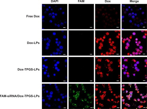 Figure 4 The cellular uptake and intracellular distribution of Dox and FAM-siRNA in H22 cells after being treated with free Dox, Dox-LPs, Dox-TPGS-LPs, or FAM-siRNA/Dox-TPGS-LPs (Dox, 5 µg/mL) for 4 hours.Notes: Blue DAPI staining indicates the nucleus, and green FAM indicates siBcl-2 in the images. Scale bars represent 10 µm.Abbreviations: Dox, doxorubicin; FAM, fluorescein amidite; LPs, liposomes; siBcl-2, Bcl-2 siRNA; TPGS, D-α-tocopherol polyethylene glycol 1000 succinate.