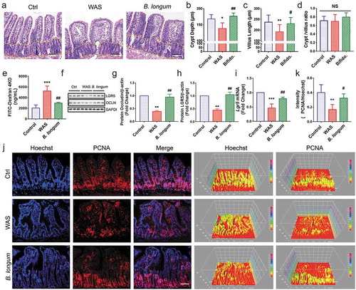 Figure 4. Bifidobacterium longum (B.longum) restored intestinal epithelial cell proliferation and enhanced mucosal repair in water avoidance stress (WAS) rats. (a) H&E staining of representative ileal sections of the rats from the three groups. The dashed line indicates the position of intestinal crypt. Scale bar = 100 μm. (b–d) Morphometric quantification of the intestinal crypt depth (b), villus height (c), and crypt/villus ratio (d) from five well-preserved crypts per slide of 8 rats from each group. Data are shown as the mean ± SD, (B) *, p = .0173 of Ctrl vs WAS, ##, p = .0014 of B. longum vs WAS (C).**, p = .0096 of Ctrl vs WAS, #, p = .0436 of B. longum vs WAS. (D) p = .9710 of Ctrl vs WAS, p = .2626 of B. longum vs WAS. (e) Intestinal permeability assay to detect intestinal permeability by measuring the concentration of FITC-D4000 in the rat serum from the three groups (n = 4 per group). Data are shown as the mean ± SD, ***, p = .0001 of Ctrl vs WAS, ##, p = .0018 of B. longum vs WAS. (f–h) Western blot analysis of occludin and LGR5 protein expression in the ileal tissue of 3 representative individual rats from each group. Quantification of GAPDH-normalized band intensity by Image-Pro Plus; data are shown as the mean ± SD, (g) **, p = .0023 of Ctrl vs WAS, ##, p = .0037 of B. longum vs WAS, n = 3, (h) **, p = .0022 of Ctrl vs WAS, ##, p = .0014 of B. longum vs WAS, (k) **, p = .0019 of Ctrl vs WAS, ##, p = .0271 of B. longum vs WAS, n = 3. (i) QPCR analysis of Lgr5 mRNA expression dissected from ileal tissues of the three groups. Data are shown as the mean ± SD, ***, p = .0007 of Ctrl vs WAS, ##, p = .0095 of B. longum vs WAS, n = 3. (j) Representative images of intestinal epithelial cells of ileal sections of rats from the three groups with PCNA (red) staining. The intensity of the cell nucleus and PCNA was quantified by Image J software. Scale bar = 100 μm. Results in (J) are shown as the average values of 5 sections per rat of 5 rats from each group. Data are shown as the mean ± SD, *, p = .0019 of Ctrl vs WAS, #, p = .0271 of B. longum vs WAS.