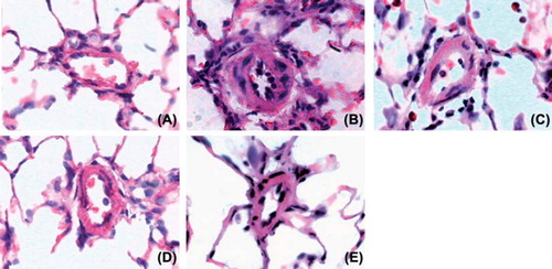 Figure 3. Photomicrographs of the pulmonary arteries in the control group (A), PH group (B), simvastatin group (C), tadalafil group (D) and combination group (E) (× 400; HE staining). A histological examination of the lung revealed a marked increase in pulmonary arterial wall thickening in the PH group. This increase in thickening was attenuated in the simvastatin, tadalafil and combination groups.