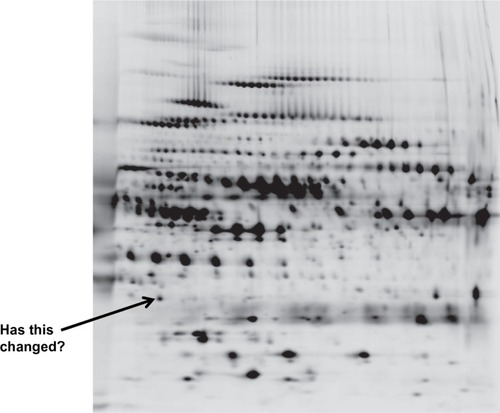 Figure 5 A two dimensional proteomics read out. Each dot/blot represents a single peptide. Changes in density/presence are considered as biomarkers of the disease progress or activity.