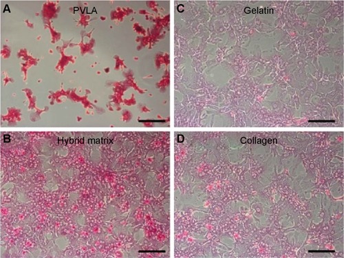 Figure 7 The storage of glycogen (red) in primary hepatocytes on various surfaces after 1 day in culture.Notes: The surfaces include a PVLA-coated dish (A), the hybrid matrix (B), a gelatin-coated dish (C), and a collagen-coated dish (D). Scale bar: 50 μm.Abbreviation: PVLA, poly-(N-p-vinylbenzyl-4-O-β-D-galactopyranosyl-D-gluconamide).